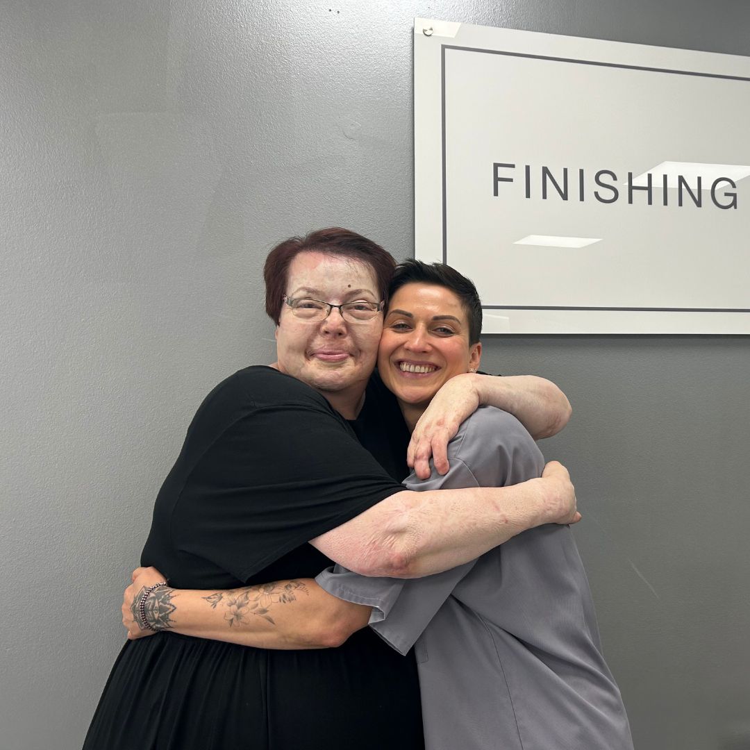 Eyebrows After 30 Years - Sue's Micropigmentation Journey