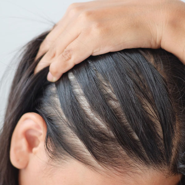 Female Hair Loss – What’s It All About And Can Anything Help?
