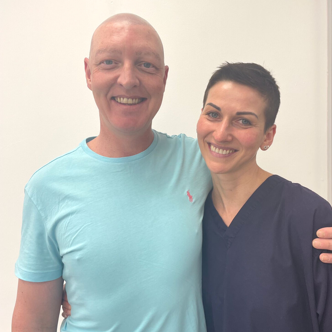 Eyebrow & Scalp Micropigmentation For Alopecia Universalis Results