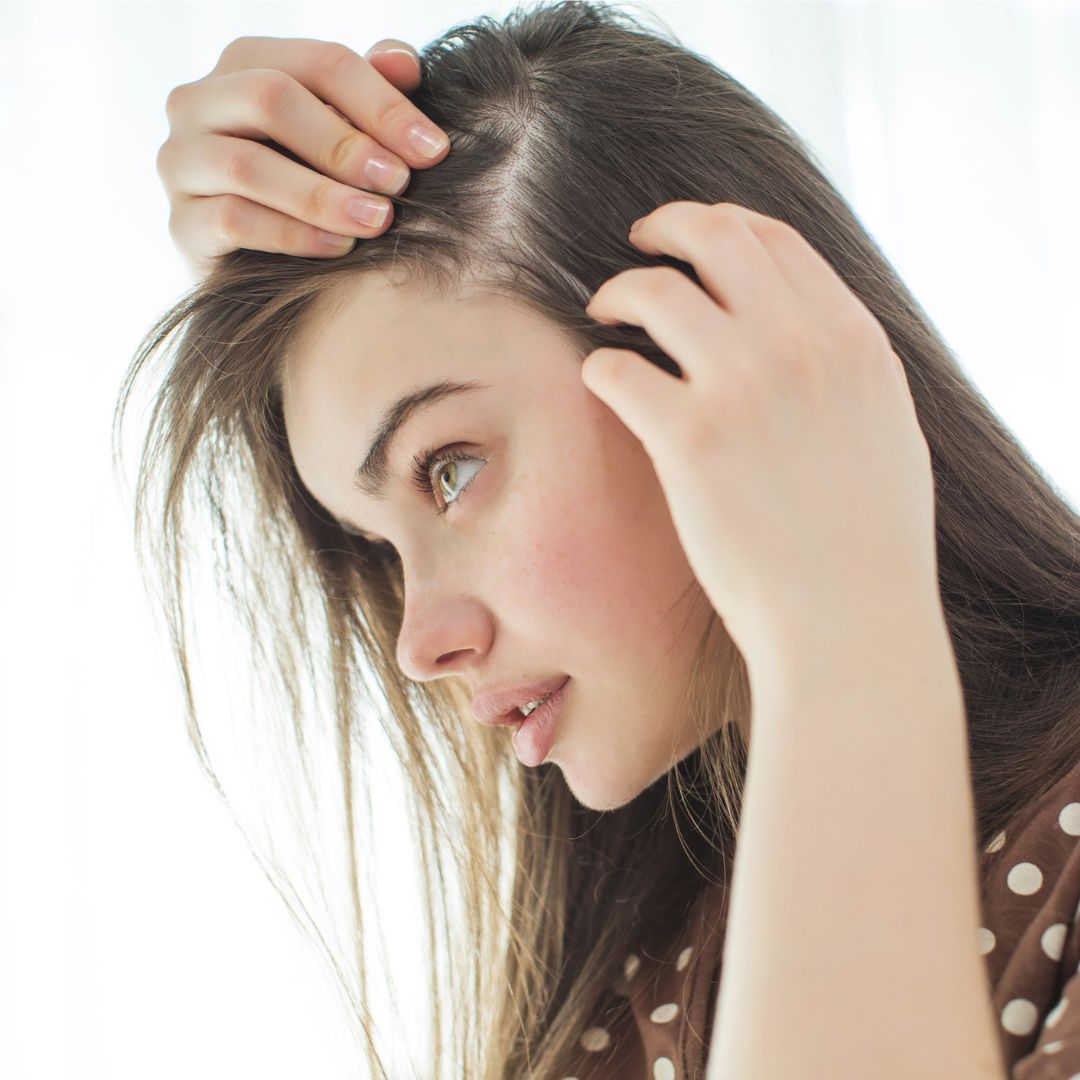 Female Temple Hair Loss