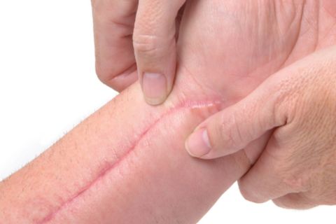 Scar In Body body skin treatments – FTG Clinics